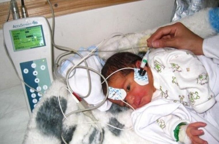 بیش از ۶۲ هزار نوزاد خوزستانی غربالگری شنوایی شدند